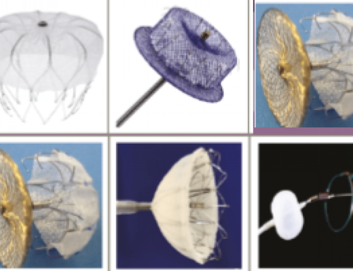 Left Atrial Appendage Occlusion: A Valid Option to Anticoagulation for Stroke Prevention